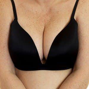 Irritating, Embarrassing Rash Under Breasts Can Be Managed with Simple Home  Remedies