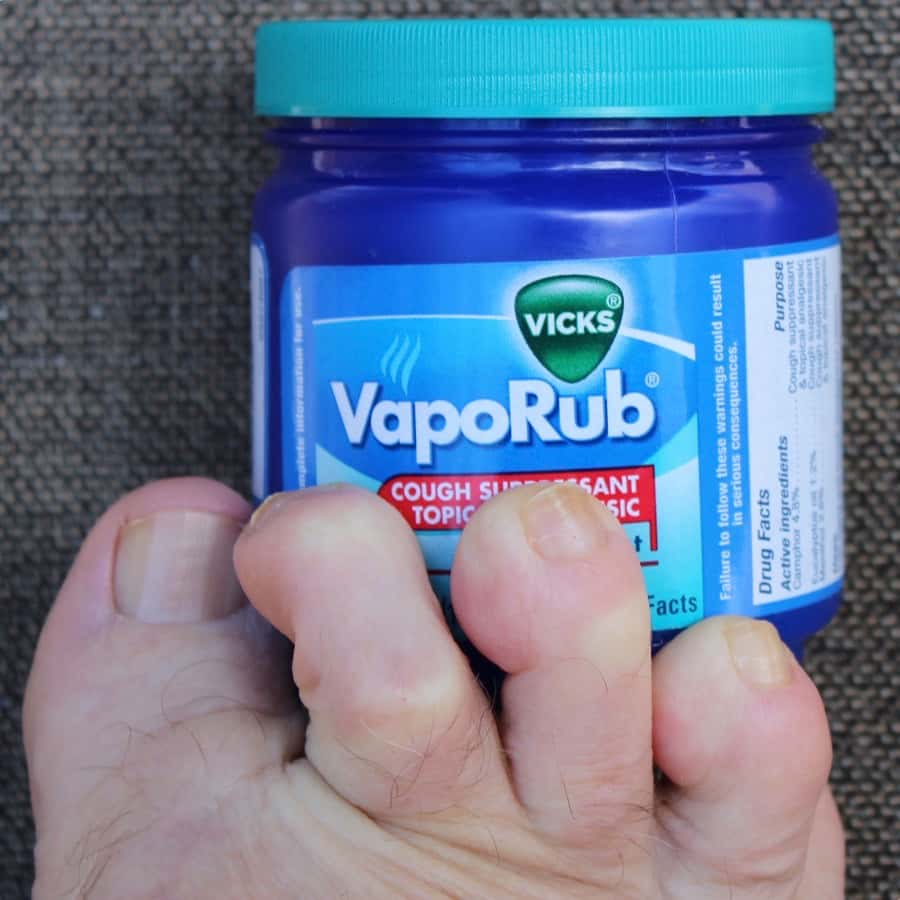 Vicks vaporub for hot sale cracked feet