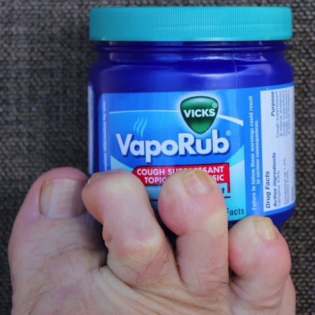 Why Does Vicks VapoRub Help Against Some Nail Fungus & Not O… | The