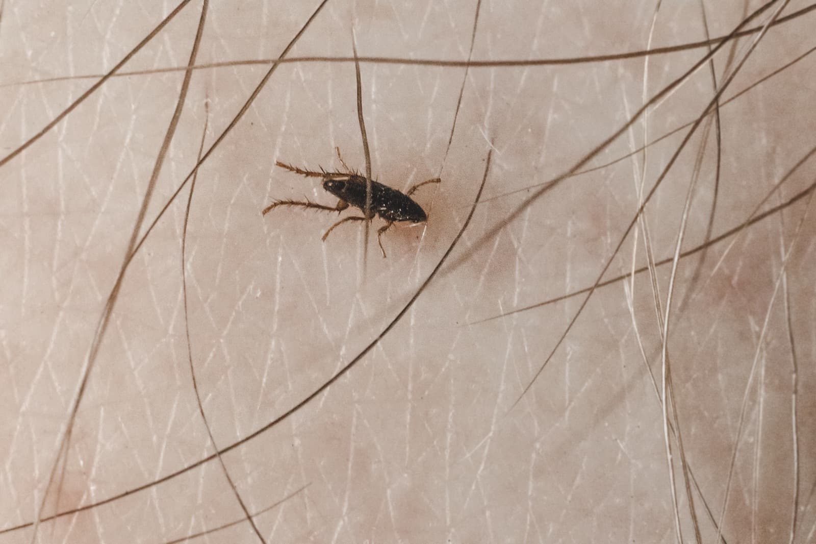 Flea and tick bites transmit dangerous pathogens to humans